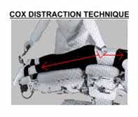 COX Distraction Technique